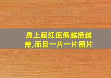 身上起红疙瘩越挠越痒,而且一片一片图片