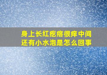 身上长红疙瘩很痒中间还有小水泡是怎么回事