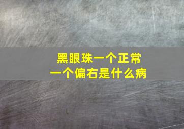 黑眼珠一个正常一个偏右是什么病